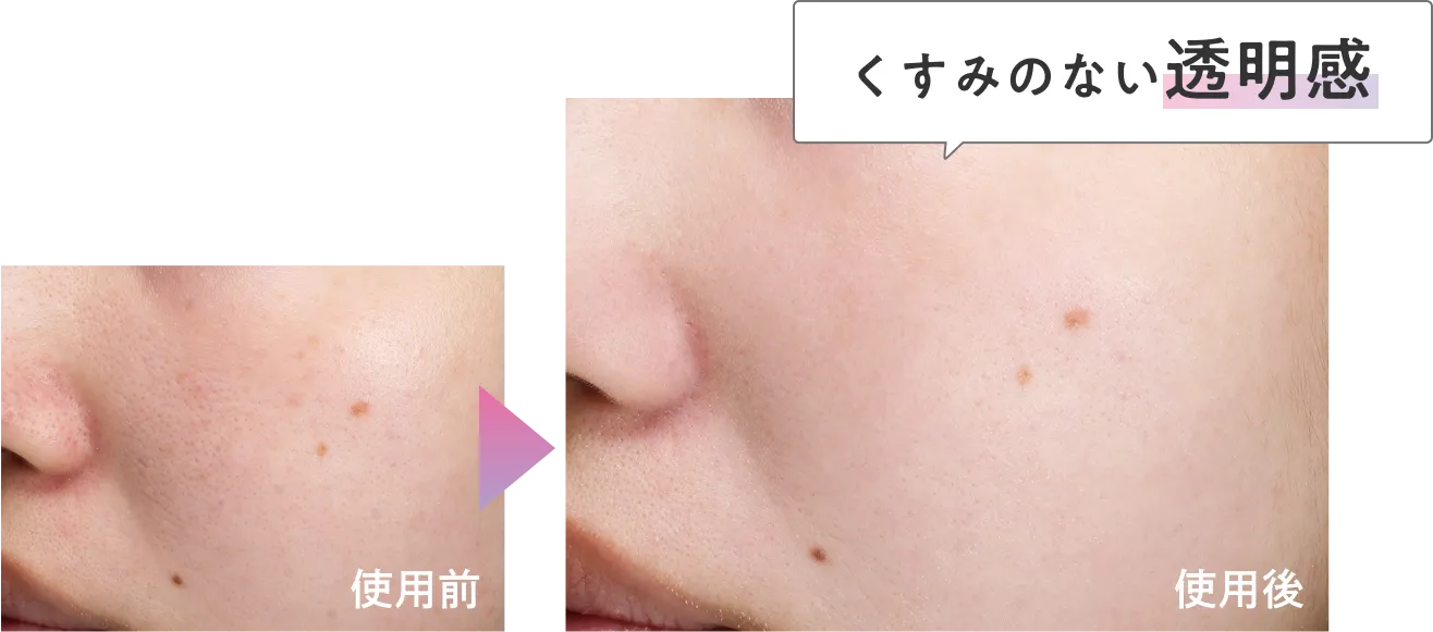 くすみのない透明感