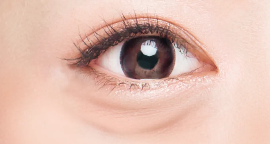 クマ・くすみが目立つ人